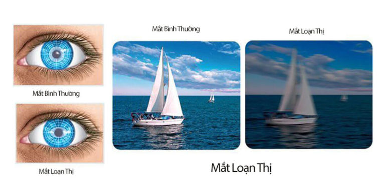 Loan Thi La 1 Tat Roi Loan Khien Mat Nhin Nhoe Khi Nhin Anh 768x379